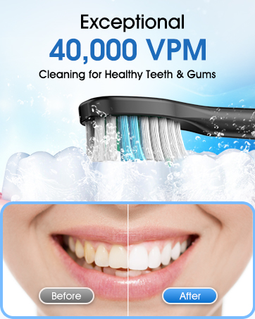 Cemobene Sonic Electric Toothbrush 506C Details 9